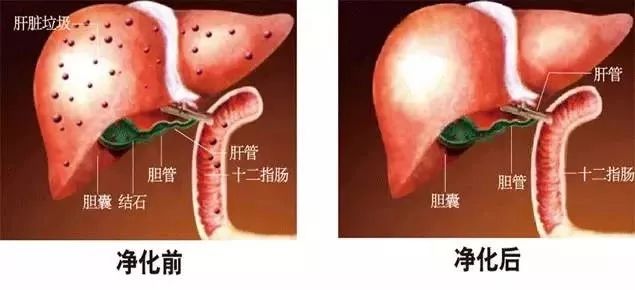 中医药调理肝脏健康与排毒功能提升之道